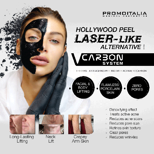 [VM-V CARBON SYSTEM] V CARBON SYSTEM 30 TRT